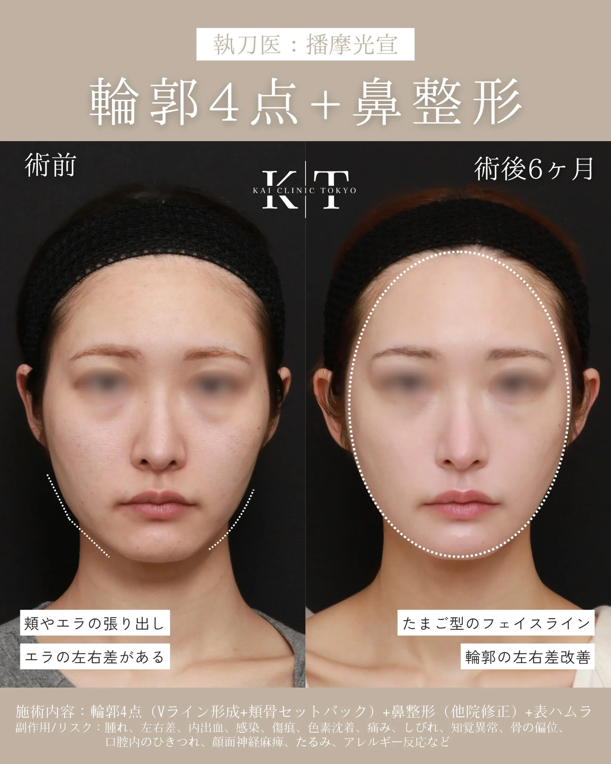 症例メディア