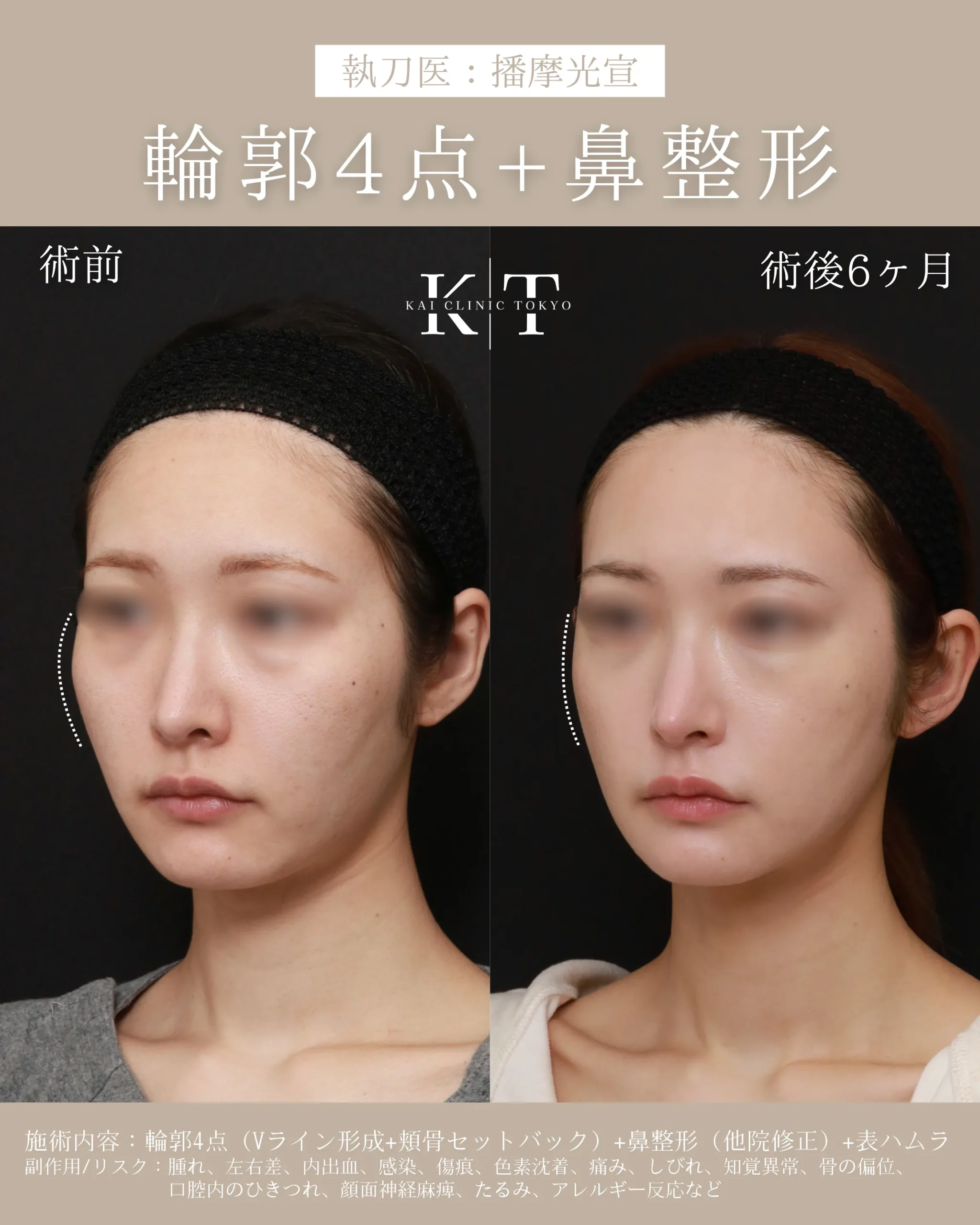 症例メディア