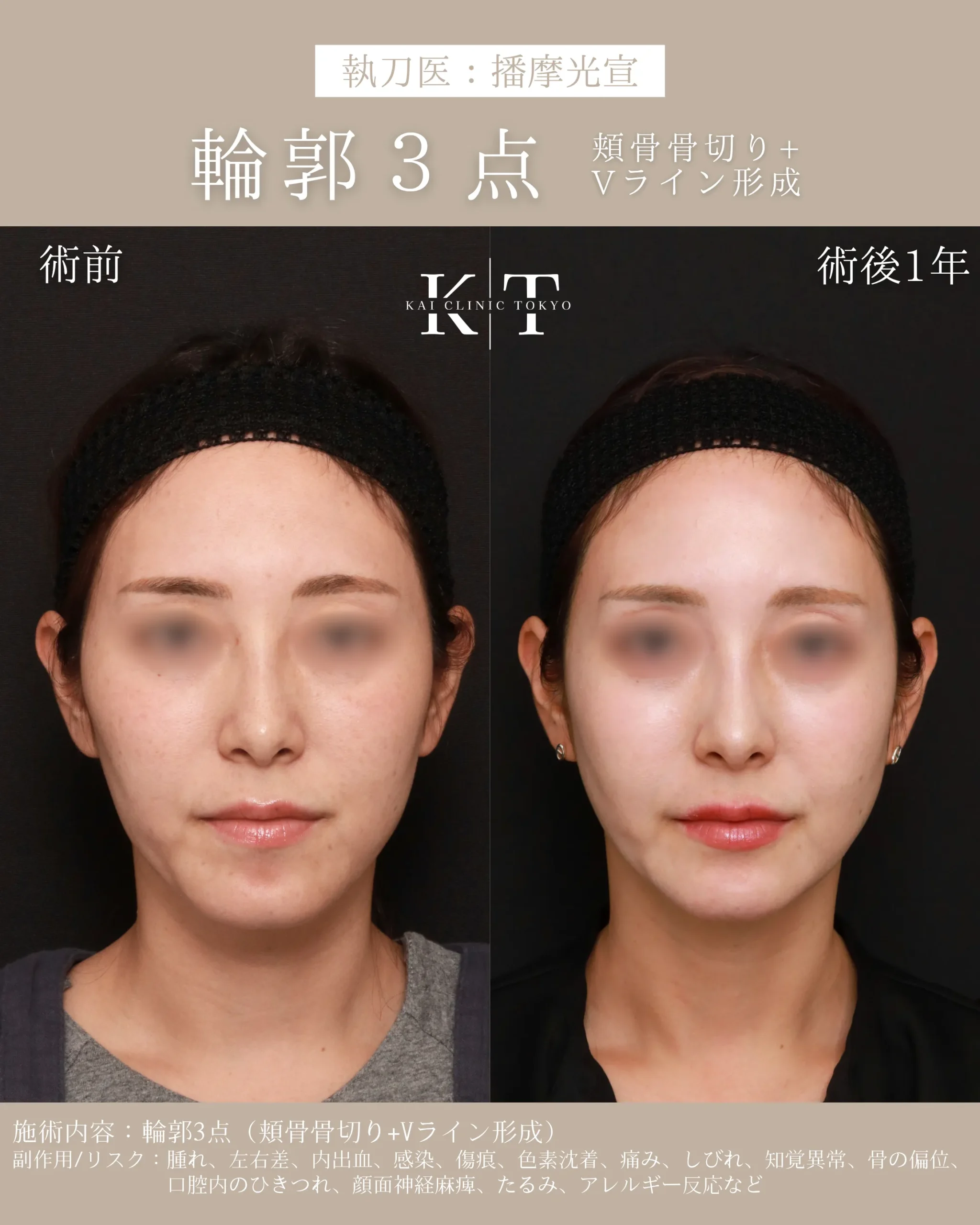 輪郭3点【30代女性】