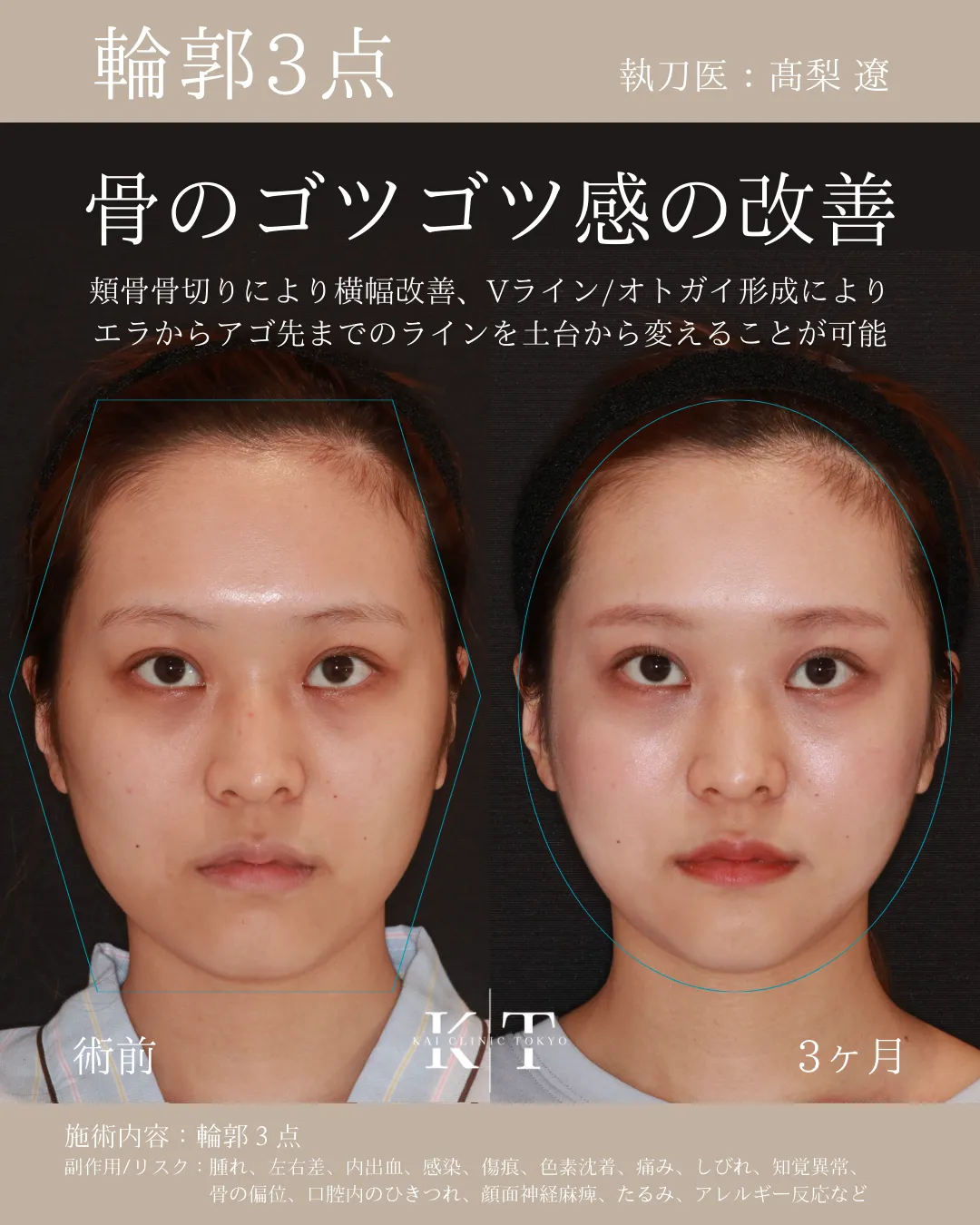 輪郭3点の症例写真